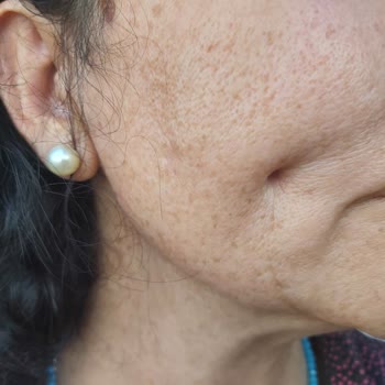 Estetika Ve Dr. Murat Acar Hakkında Şikayet