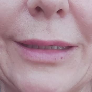 Estetika Ve Dr. Murat Acar Hakkında Şikayet