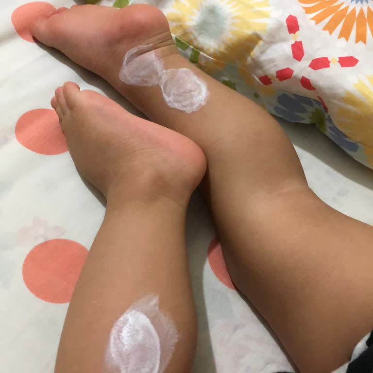 Siveno Sinek Kovucu Sprey Beklentileri Karşılamadı