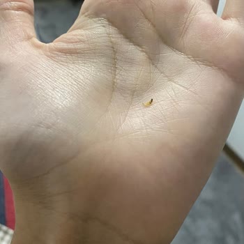 İndomie Noodlenin İçinden Tırnak Tarzı Bir Şey Çıktı