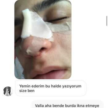 Gardrops Kahve Makinesi Alımında Yaşanan Sorun
