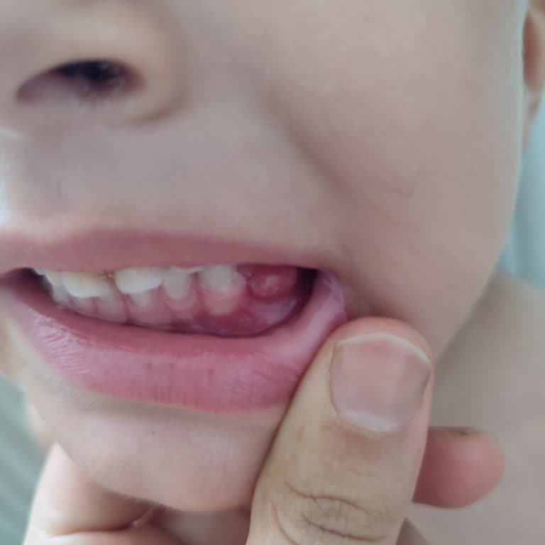 Gaziantep Üniversitesi Diş Hekimliği Fakültesi Çocuğa Bir Randevu Alamadım