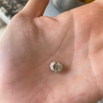 Migros Ürünü Nohudun İçinde Taş Çıktı