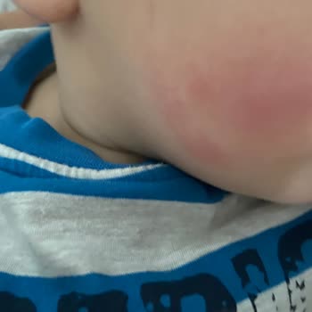 Incia Sinek İlacı Faciası