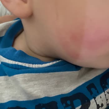 Incia Sinek İlacı Faciası