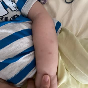 Incia Sinek İlacı Faciası