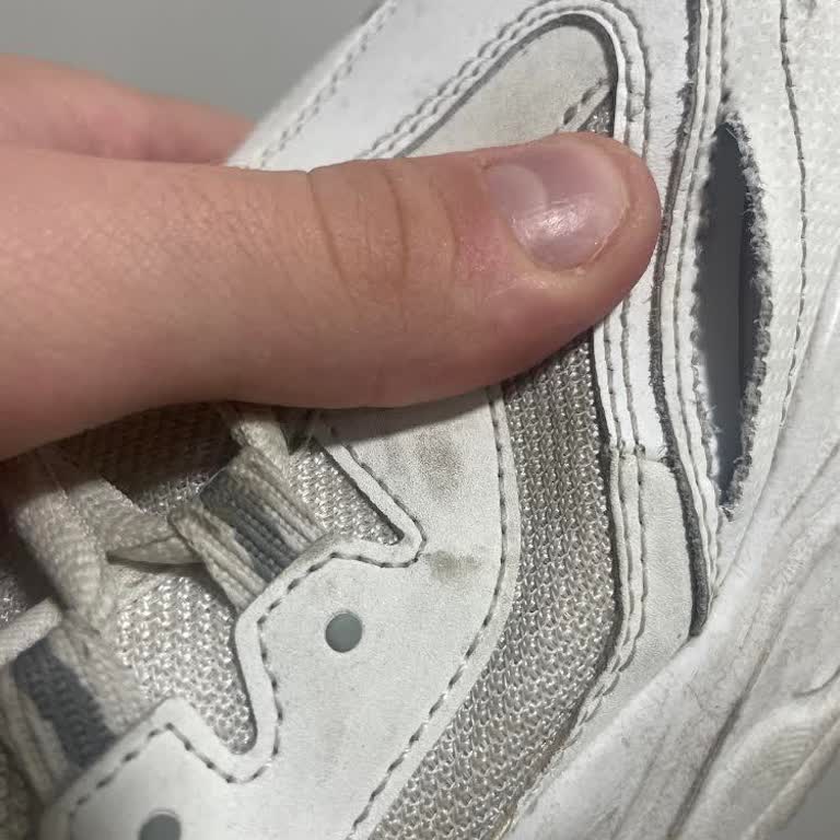 Skechers Ayakkabı Kalitesizliği Ve Skechers İlgisizliği