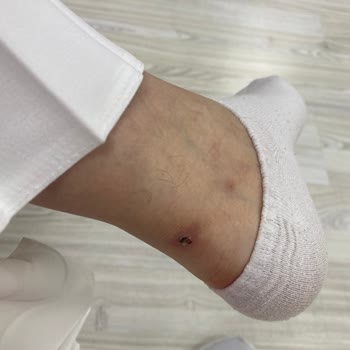 SuperStep Ayakkabı İade Sürecinde Yaşanan Sorunlar