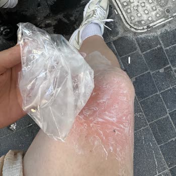 Qubish Chocolate Cafe'de Üstüme Kaynar Çay Döktüler!