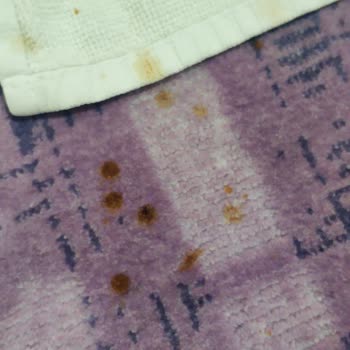 Philips Azur 8000 Serisi Ütü Ses Ve Sarı Çıkmayan Lekeler