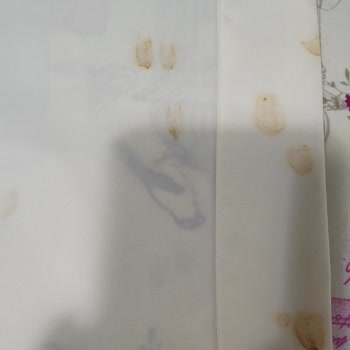 Philips Azur 8000 Serisi Ütü Ses Ve Sarı Çıkmayan Lekeler