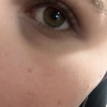 Watsons Hatalı Ürünlerde İADE/DEĞİŞİM Sorunu