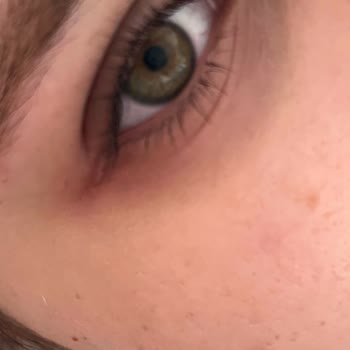 Watsons Hatalı Ürünlerde İADE/DEĞİŞİM Sorunu