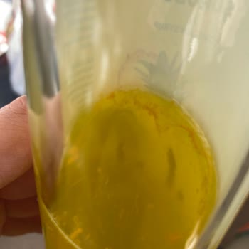 Zühre Ana Bromelain Şurubu Bozuldu