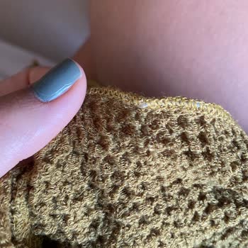Zara Defolu Elbise Ücret İadesi