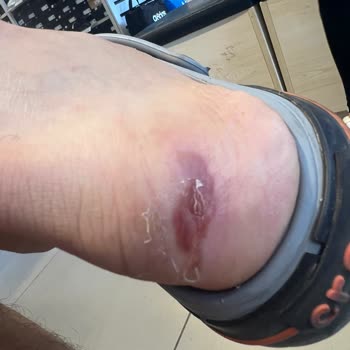 Adidas Satış Sonrası Hizmet Sıfır