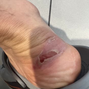 Adidas Satış Sonrası Hizmet Sıfır