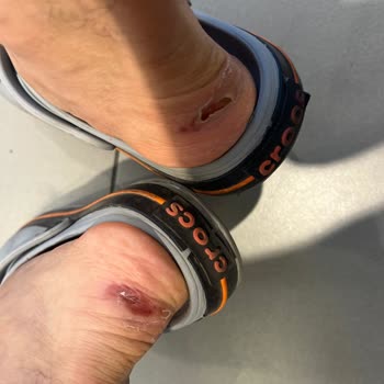 Adidas Satış Sonrası Hizmet Sıfır