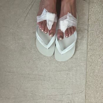 Havaianas Terlik Yara Yaptı