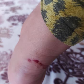 SuperStep Mağazasından Aldığım Ayakkabı Ayağımı Mahvetti!