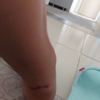 SuperStep Mağazasından Aldığım Ayakkabı Ayağımı Mahvetti!