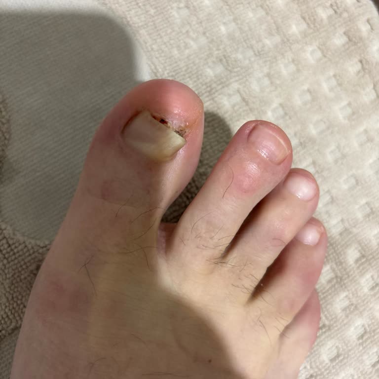 MediNail Ayak Ve Tırnak Spreyi Medinail Mantar Spreyi