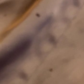 Merit Hotels Yatağı Böcek Bastı