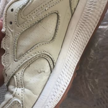 Skechers Firmasının Ürün Hatasını Kabul Etmemesi