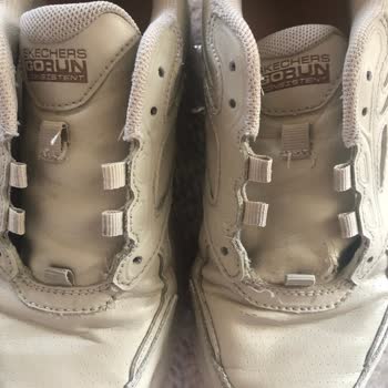 Skechers Firmasının Ürün Hatasını Kabul Etmemesi