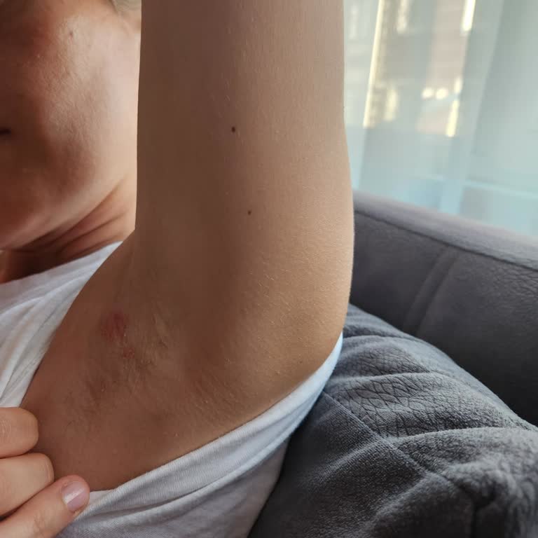 Yves Rocher Roll On Sorunu