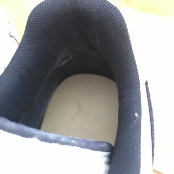 Deichmann Kızılay Ayakkabı Yırtıldı