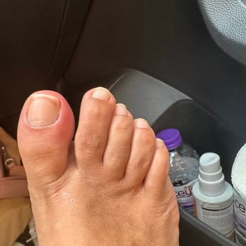 Gratis Beauty Mall Of Antalya Gratis SPA Pedikür Mikrop Kapması