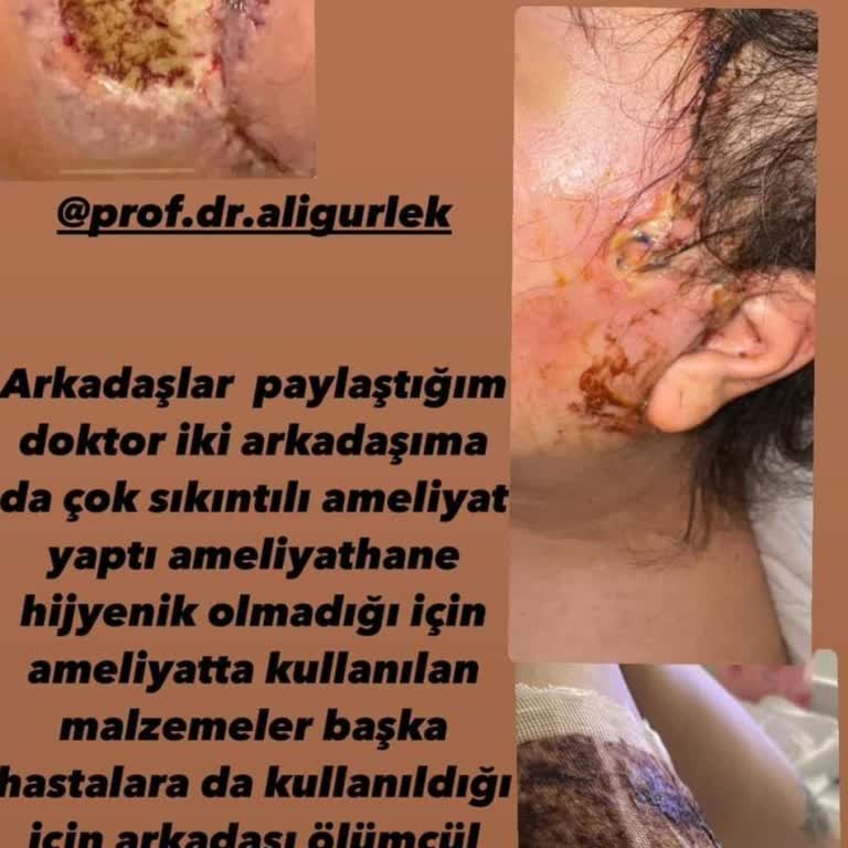 Prof. Dr. Ali Gürlek Estetik Cerrahı Estetik İşlemlerle İlgili Tarafsız Değerlendirme