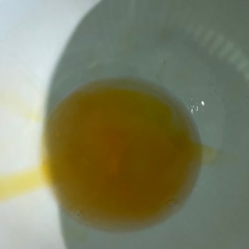 Şok Market Cepte Şok