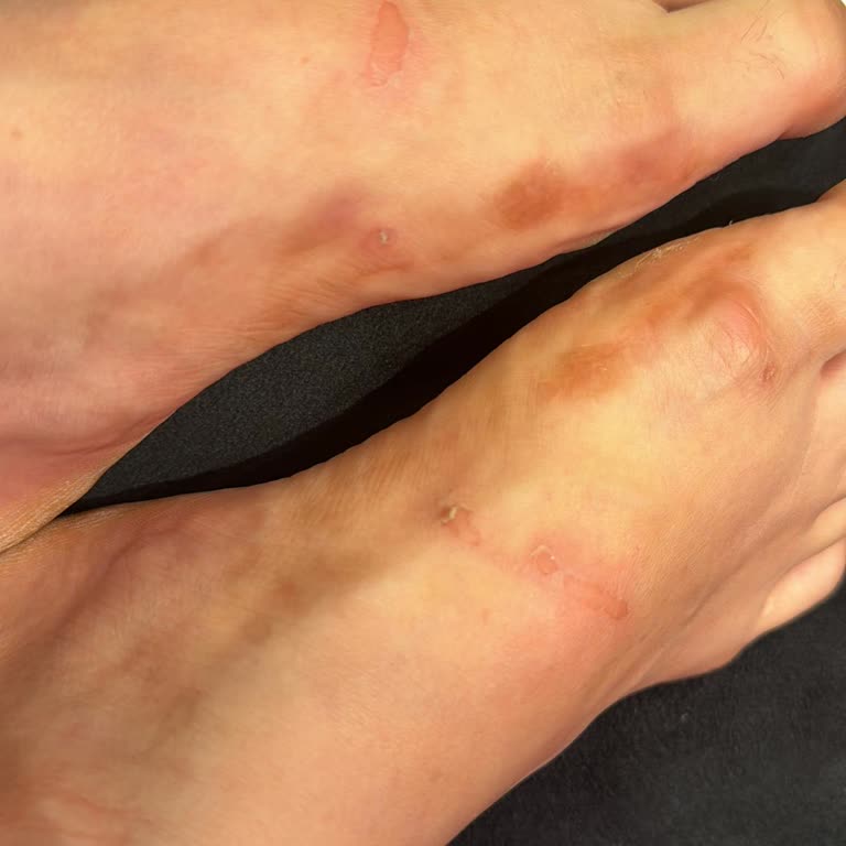 Pelin'in Ayakkabıları Sandalet Ayaklarımı Parçaladı