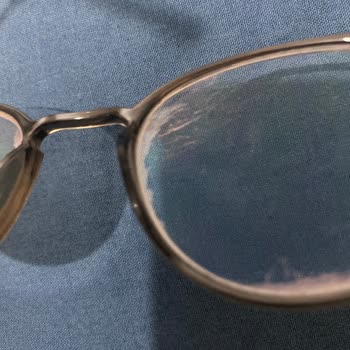 Zeiss Camımın Kaplaması Attı Diyarbakır Bölge Müdürü Sorumluluk Almadı