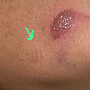 İzmit Belediyesi Çayırköy Saldırgan Köpek Sorun