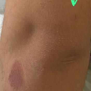 İzmit Belediyesi Çayırköy Saldırgan Köpek Sorun