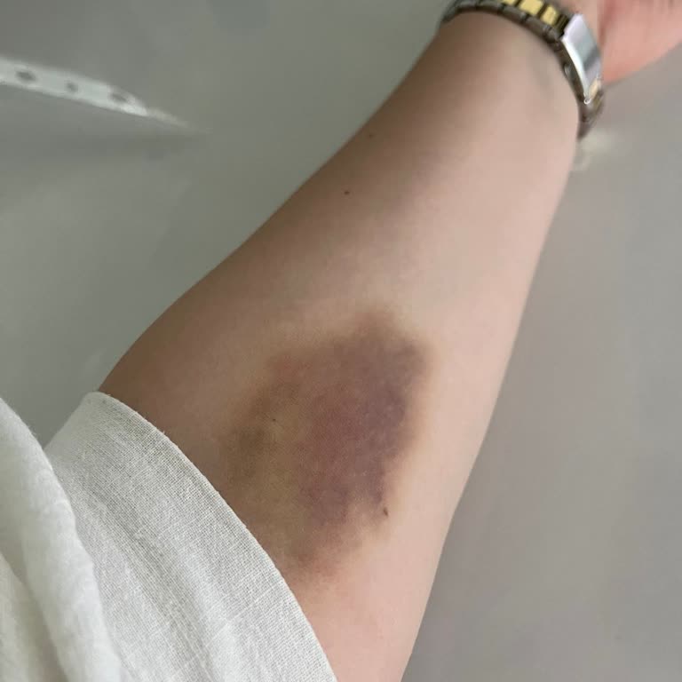 Bağcılar Şafak Hastanesi Bağcılar'daki Hastane Deneyimim