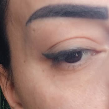 Leyla Estetik Güzellik (Ankara) Memnuniyetsizliği