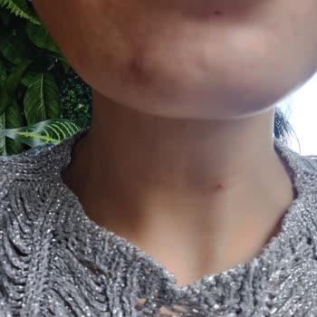 Leyla Estetik Güzellik (Ankara) Memnuniyetsizliği