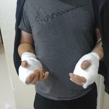 Çalışma ve Sosyal Güvenlik Bakanlığı İşten Çıkardılar Ameliyatlı Halimle