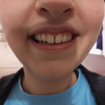 Yeni Yüzyıl Üniversitesi Diş Hekimliği Fakültesi Hastanesi Diş Tedavisinde Yaşanan Sorunlar