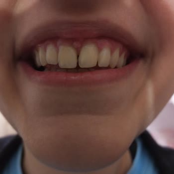 Yeni Yüzyıl Üniversitesi Diş Hekimliği Fakültesi Hastanesi Diş Tedavisinde Yaşanan Sorunlar