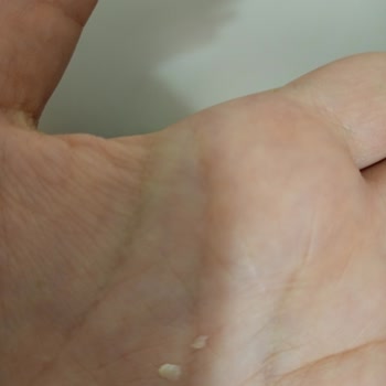 Yeni Yüzyıl Üniversitesi Diş Hekimliği Fakültesi Hastanesi Diş Tedavisinde Yaşanan Sorunlar