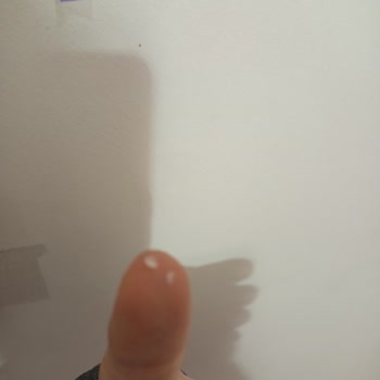 Yeni Yüzyıl Üniversitesi Diş Hekimliği Fakültesi Hastanesi Diş Tedavisinde Yaşanan Sorunlar