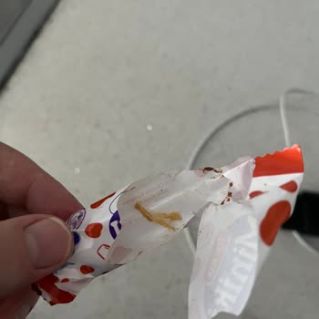 Torku Çikolata İçinde Yabancı Cisim