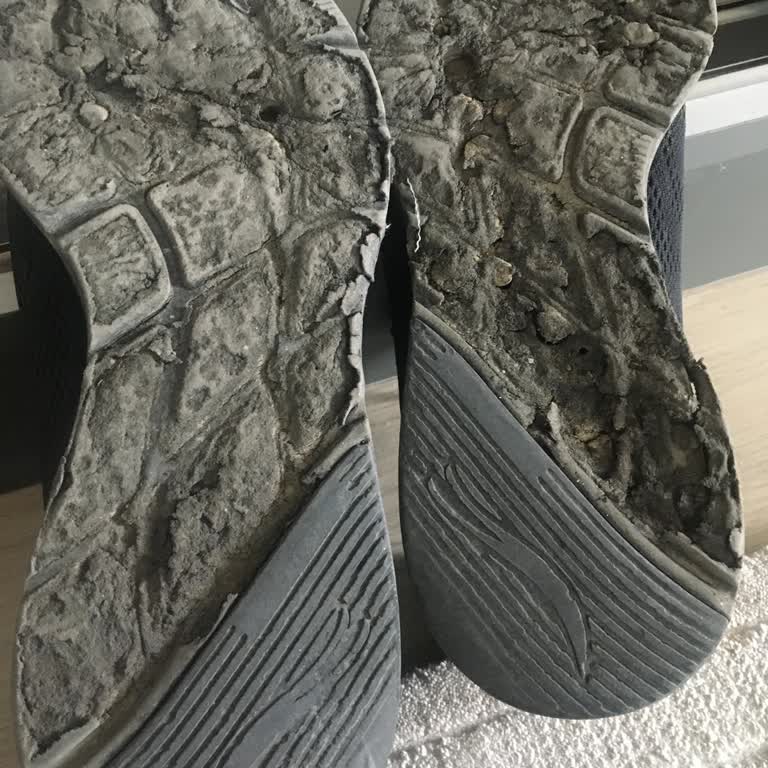 Skechers Ayakkabının Altı Param Parça Oldu