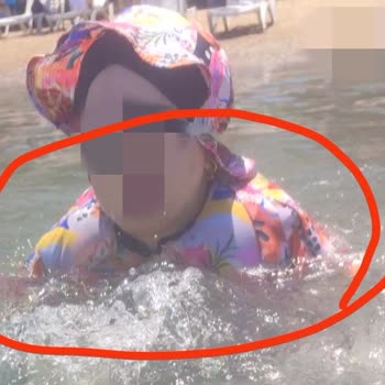 Manuka Haşema Kullanımında Yaşanan Şişme Sorunu