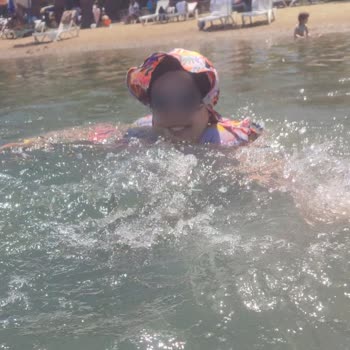 Manuka Haşema Kullanımında Yaşanan Şişme Sorunu